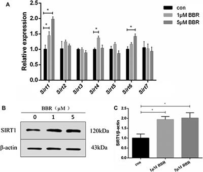 Adipose Tissue SIRT1 Regulates Insulin Sensitizing and Anti-Inflammatory Effects of Berberine